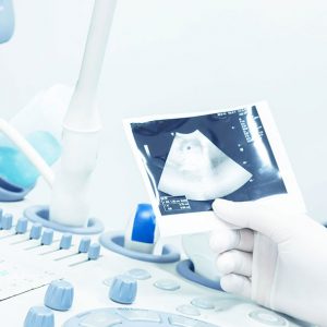 Perinatología: recepción del recién nacido e internación conjunta
